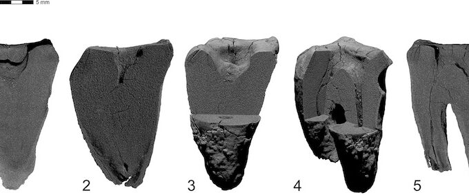 Pemindaian CT pada gigi geraham Neanderthal (dok: Jurmal Plos One)
