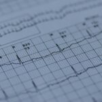 Ilustrasi Gempa (Unsplash/Joachim