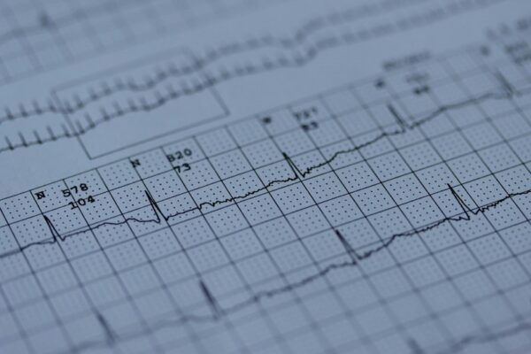 Ilustrasi Gempa (Unsplash/Joachim