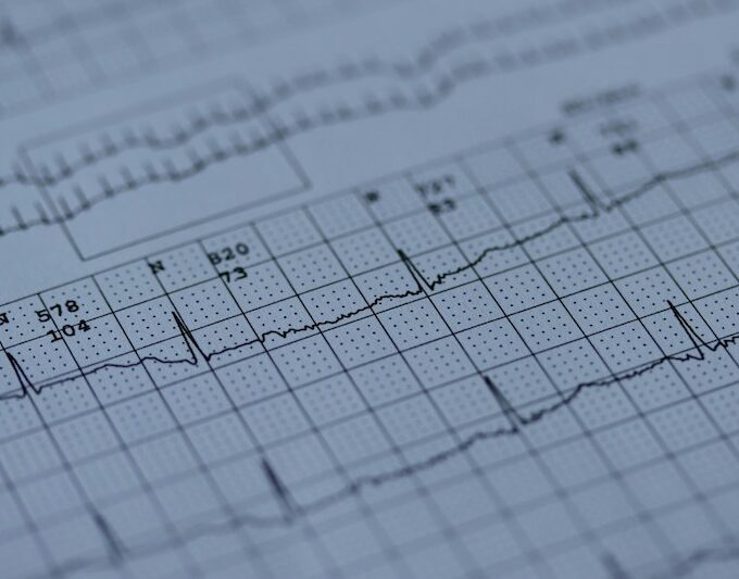 Ilustrasi Gempa (Unsplash/Joachim