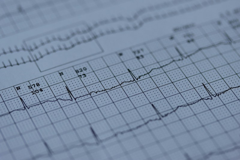 Ilustrasi Gempa (Unsplash/Joachim
